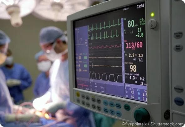 VigilantAir — AI-Assisted Anaesthesia Patient Monitoring